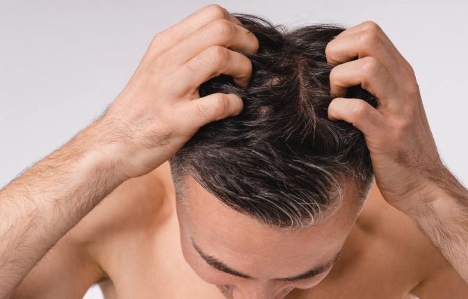 핀페시아 공식직구몰로 만나는 안전한 탈모 관리 솔루션, 핀페시아 신뢰 가이드